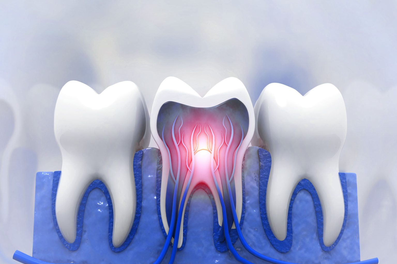 dolore nervo denti dentista bologna centro smm 1536x1024 1