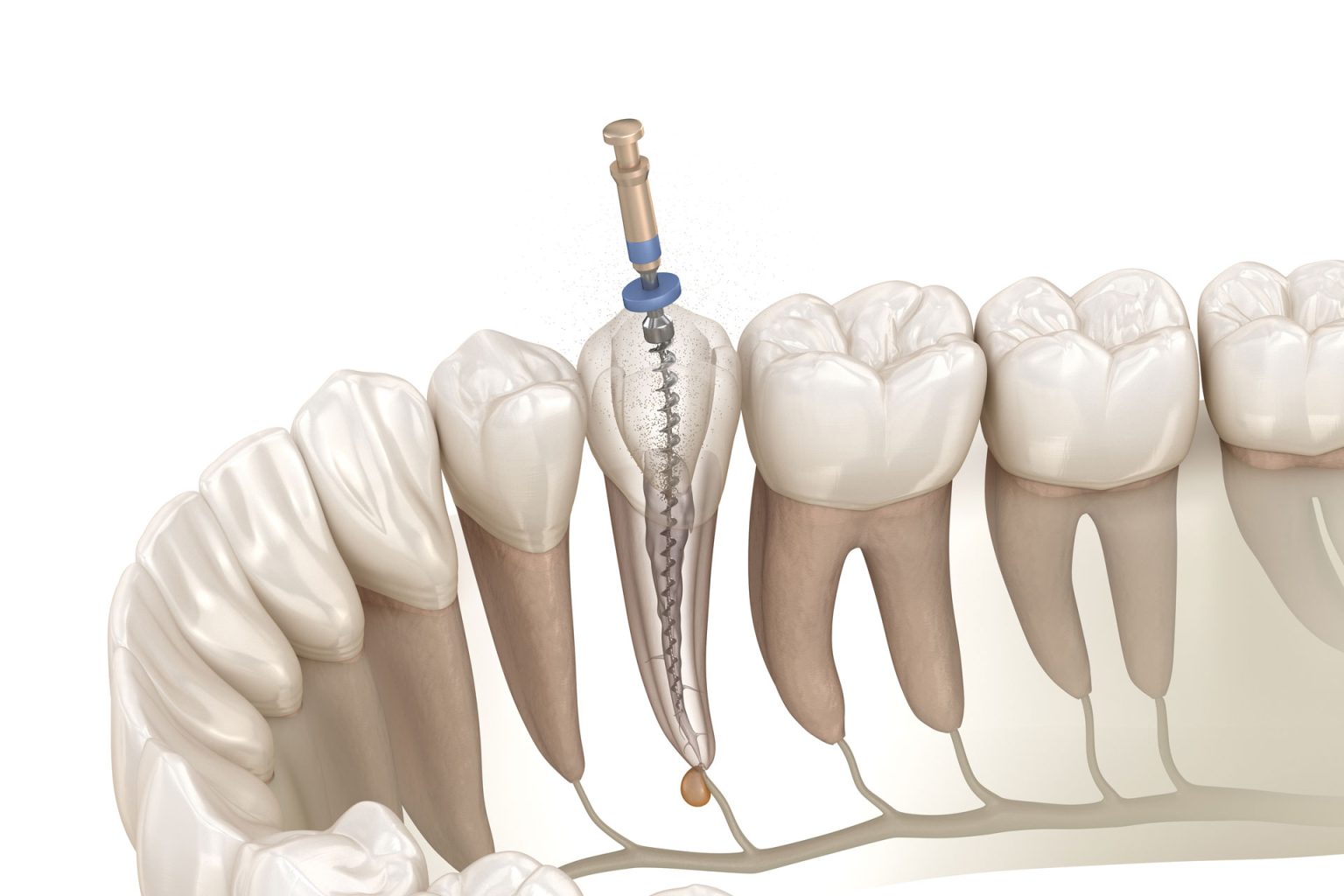 endodonzia cura canalare dentista bologna centro smm 1536x1024 1