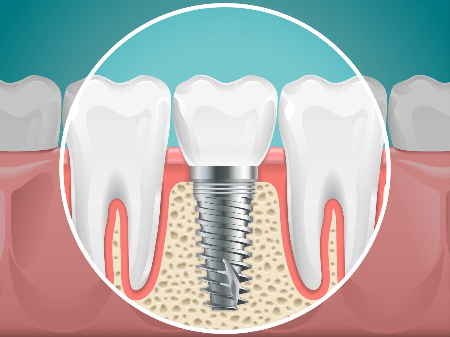 pulizia dentista